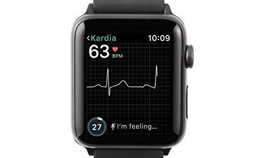Кардио ремешок Alivecor для Apple Watch